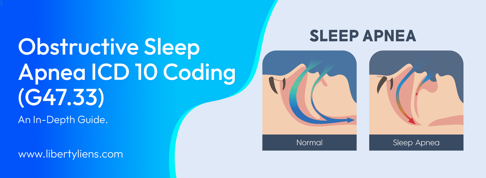 obstructive sleep apnea icd 10
