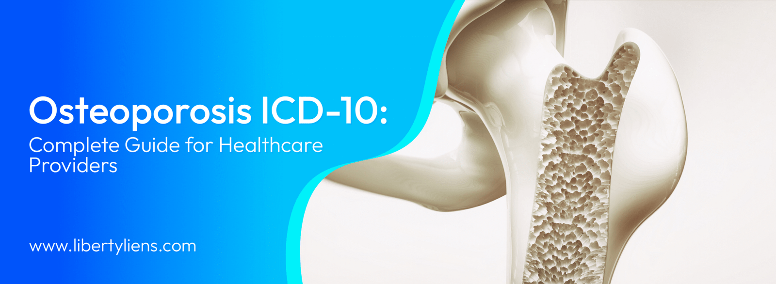 Osteoporosis ICD-10