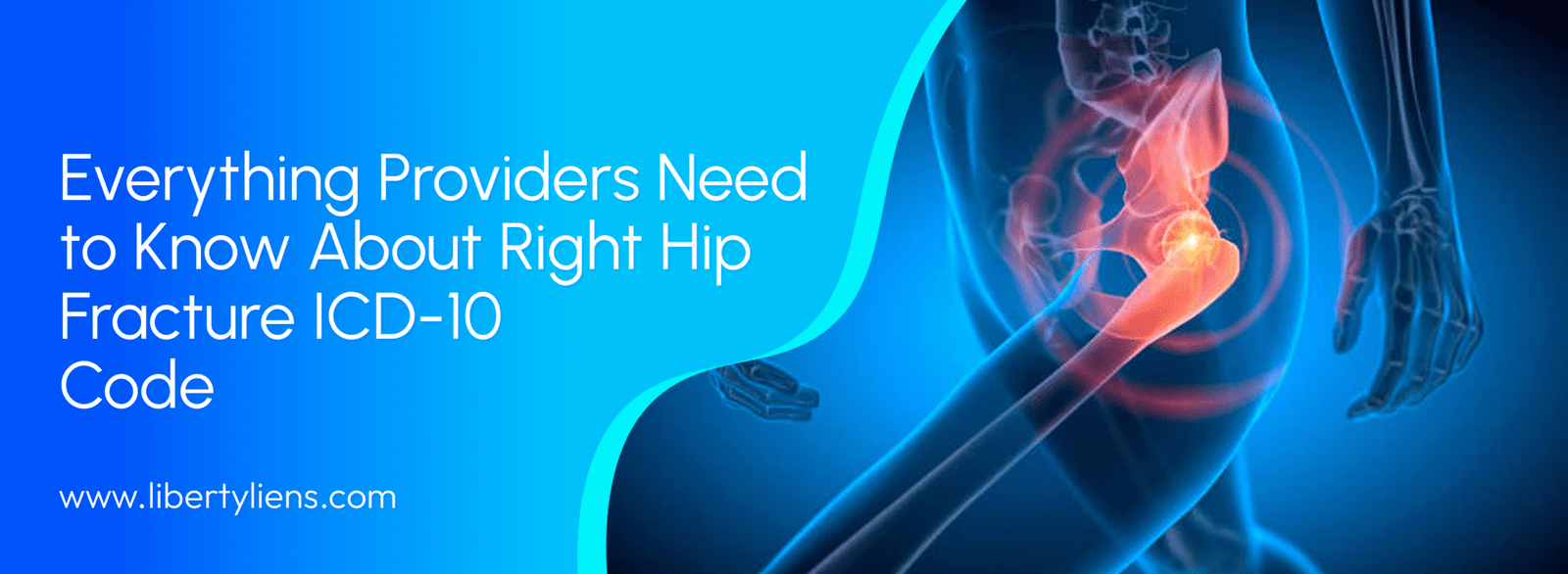 right hip fracture icd 10