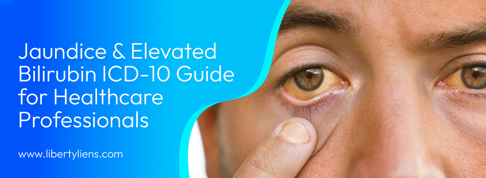 Jaundice & Elevated Bilirubin ICD-10